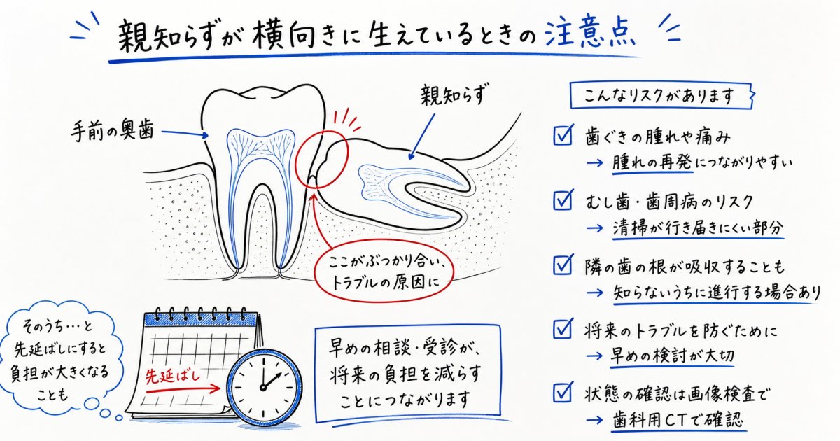 親知らずの抜歯を先延ばしにするリスク！痛みが引いても診察が必要な訳