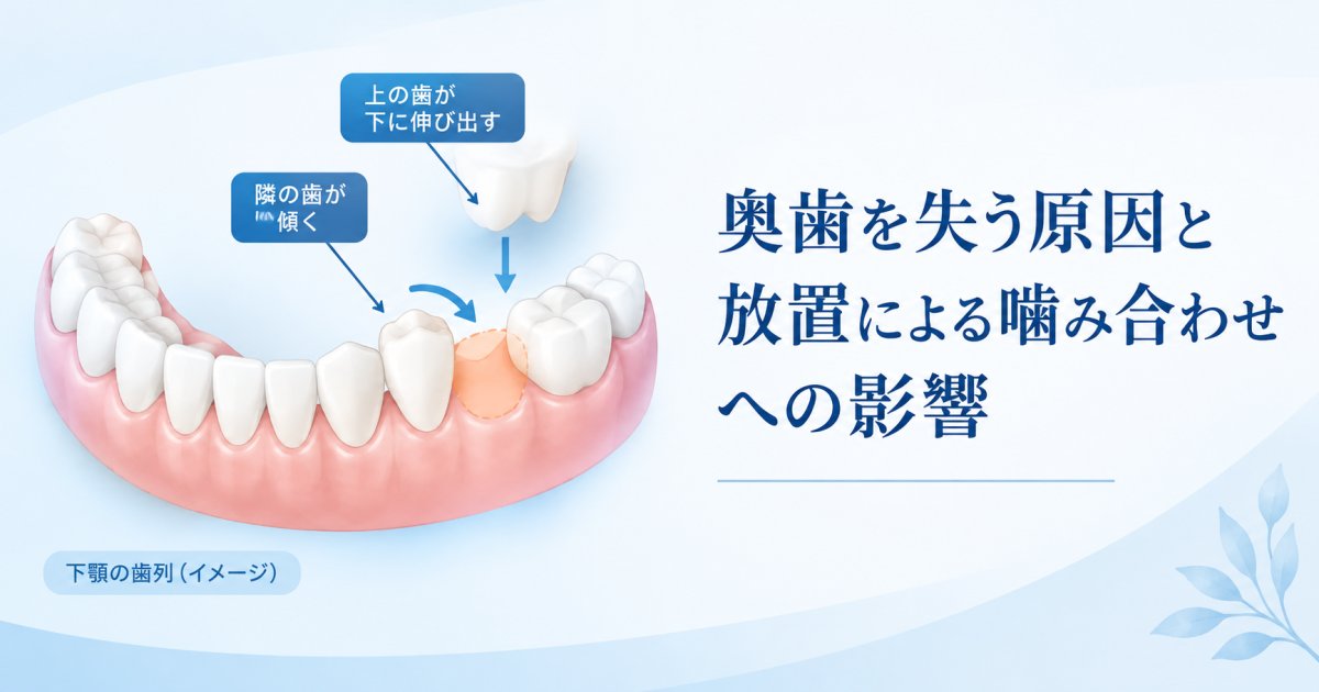 奥歯を失う原因と放置のリスクとは？噛み合わせへの影響を解説